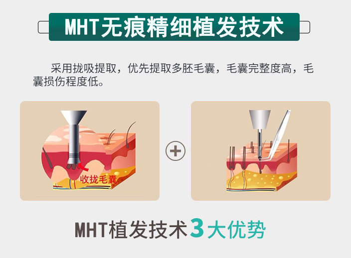 MHT�o�۾���ֲ�l(f��)���g(sh��)